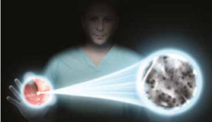 Cellvizio - laser endomicroscopy Barrett's esophagus